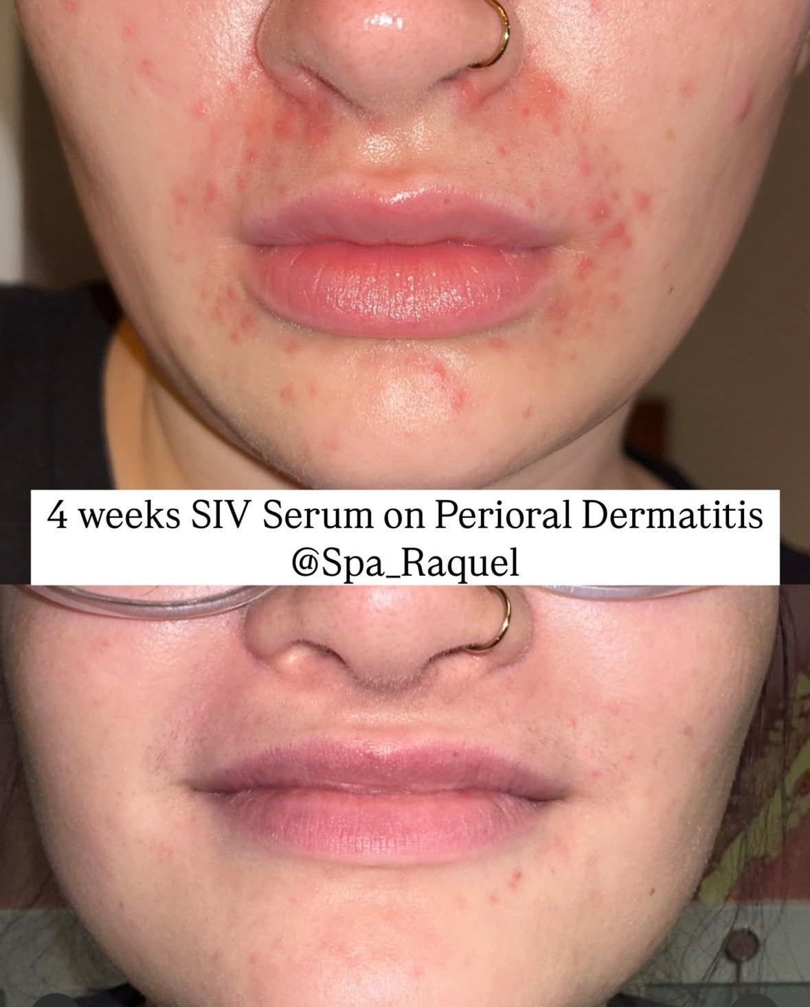 SIV Biome Balancing Serum