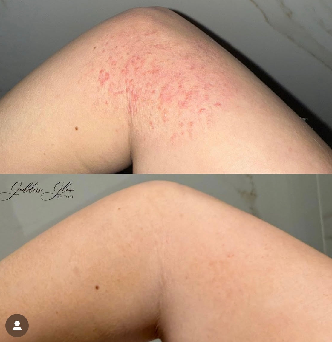 SIV Biome Balancing Serum