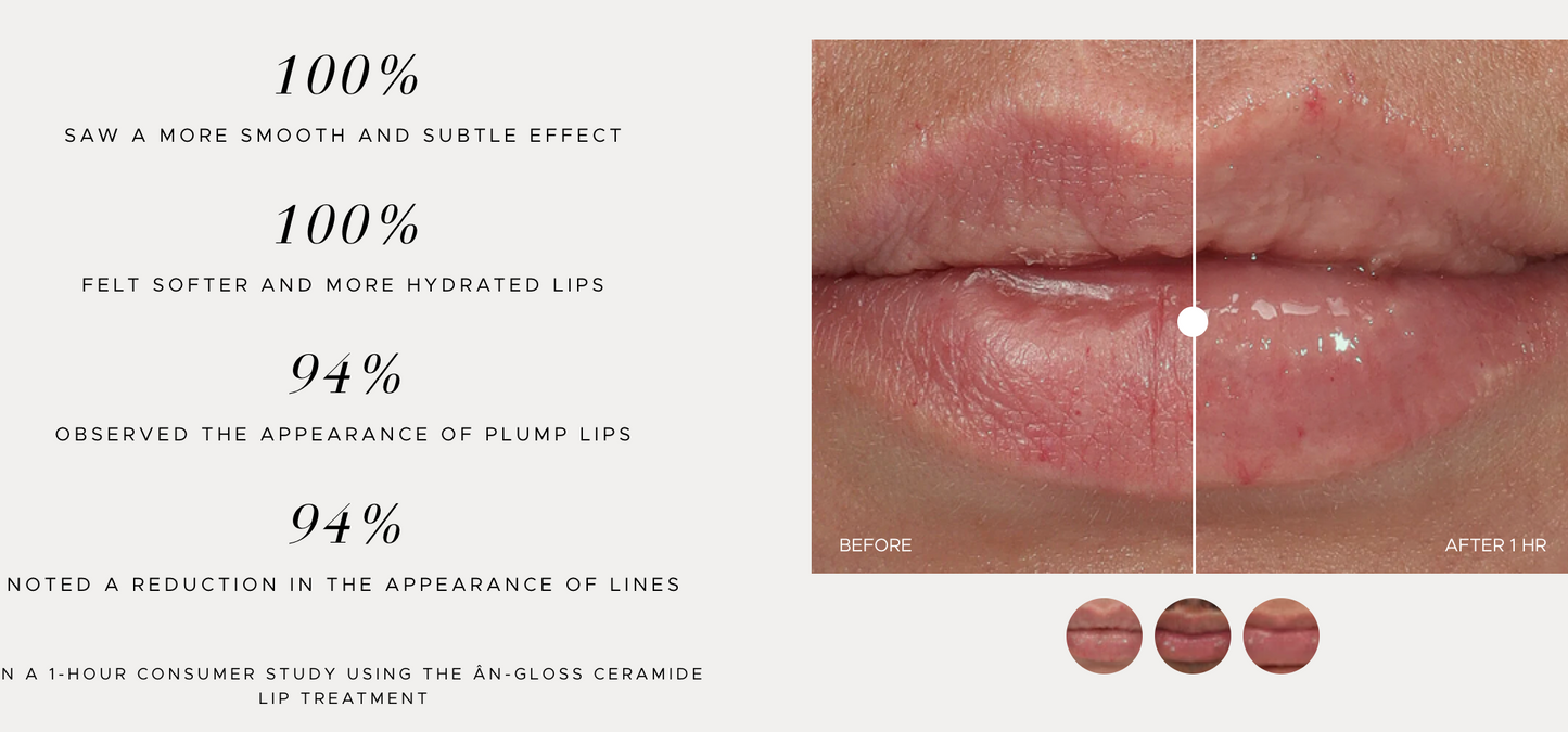 An-Gloss
