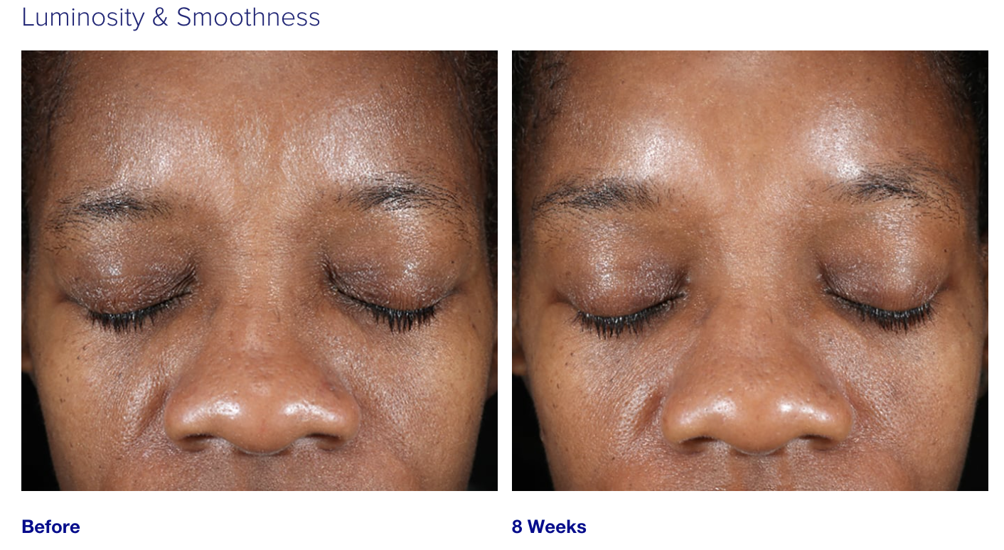 iS Clinical Active Peel System