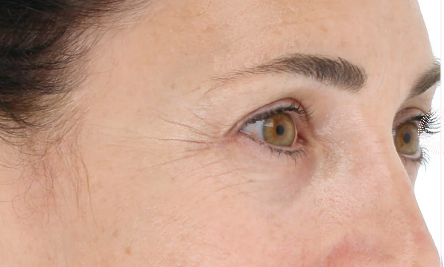 Light Stim Wrinkles
