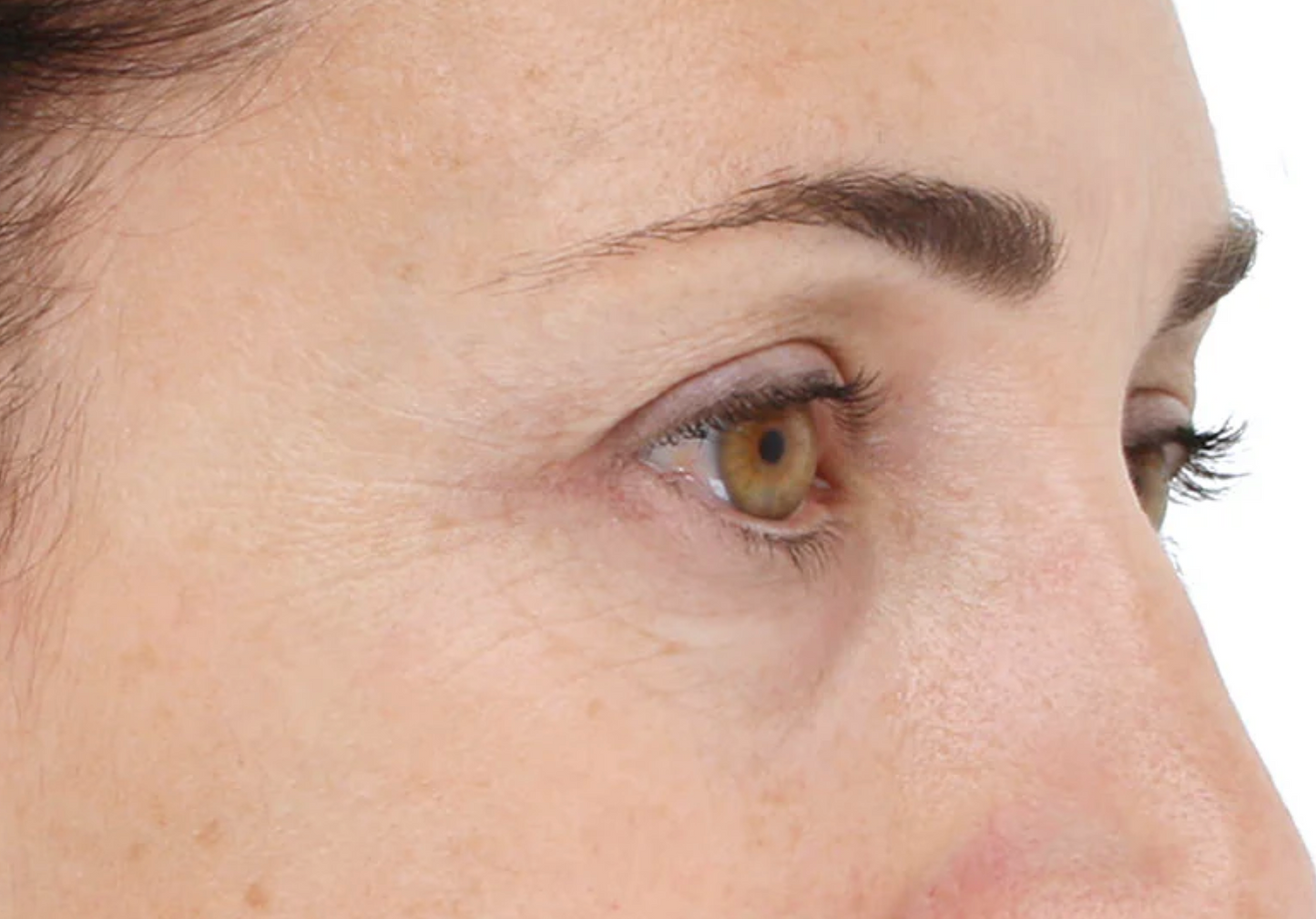 Light Stim Wrinkles