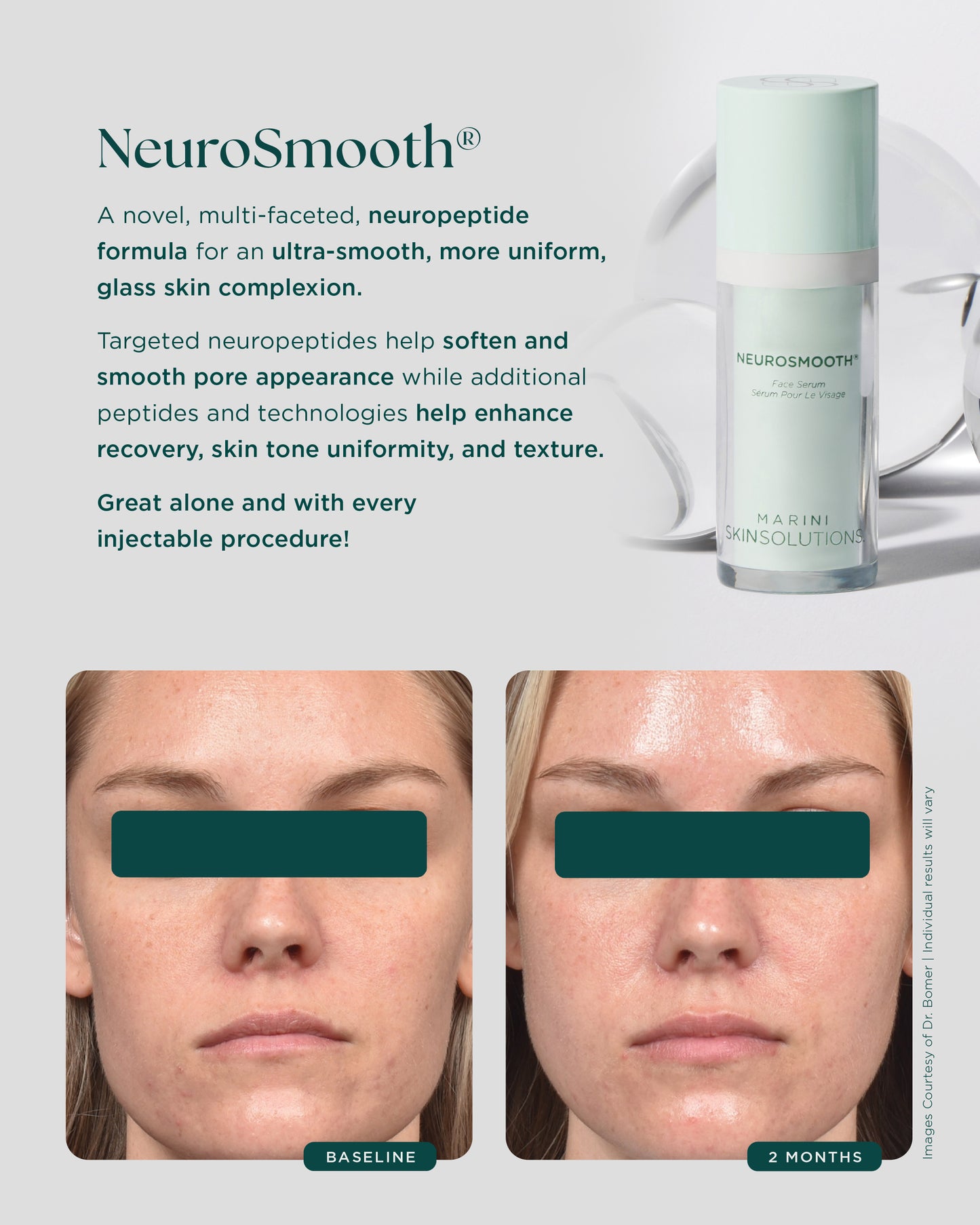 Neurosmooth