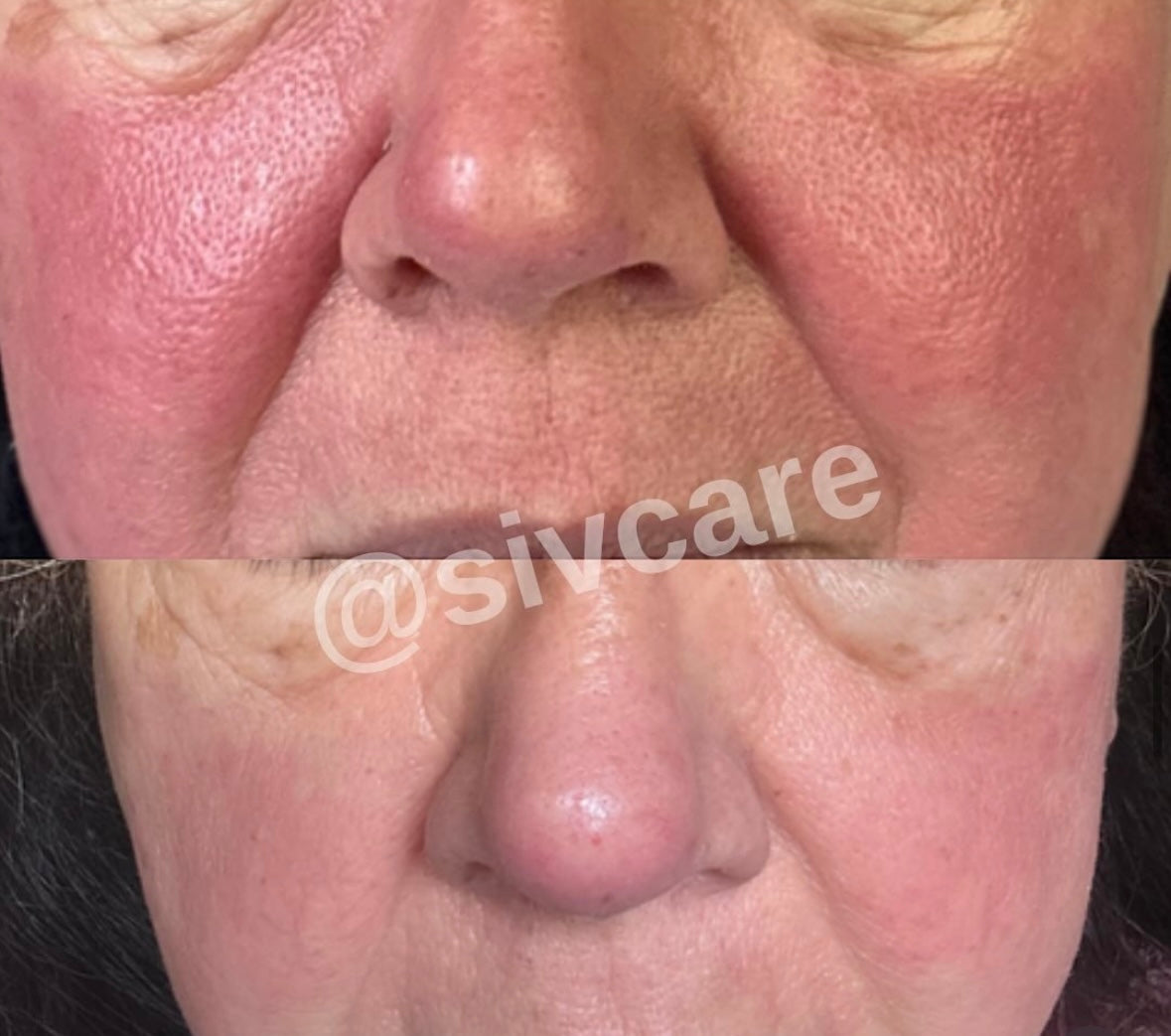 SIV Biome Balancing Serum