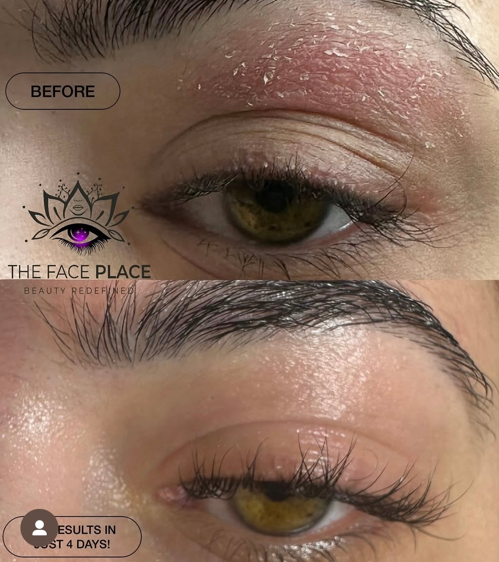 SIV Biome Balancing Serum