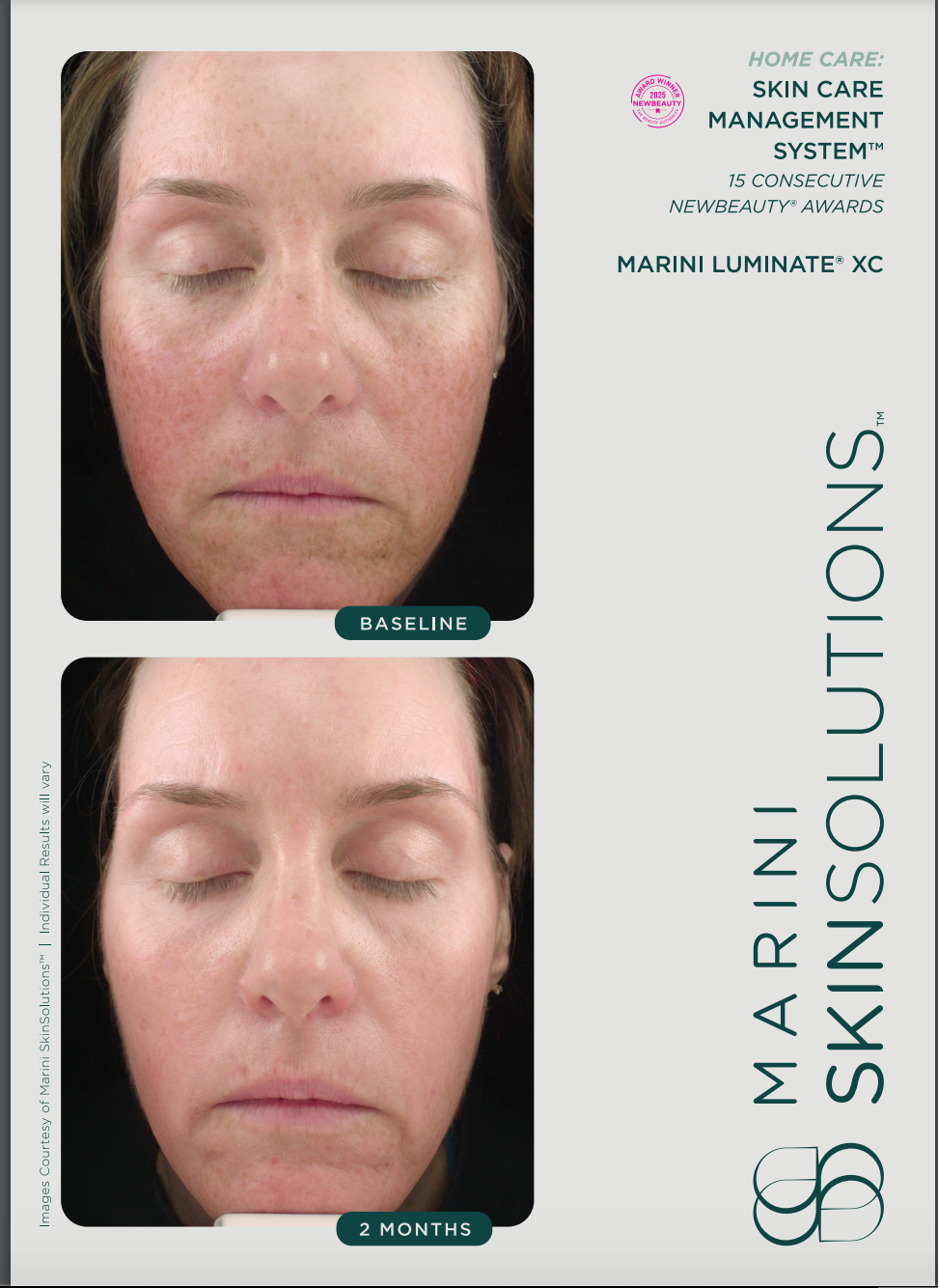 Marini Luminate XC