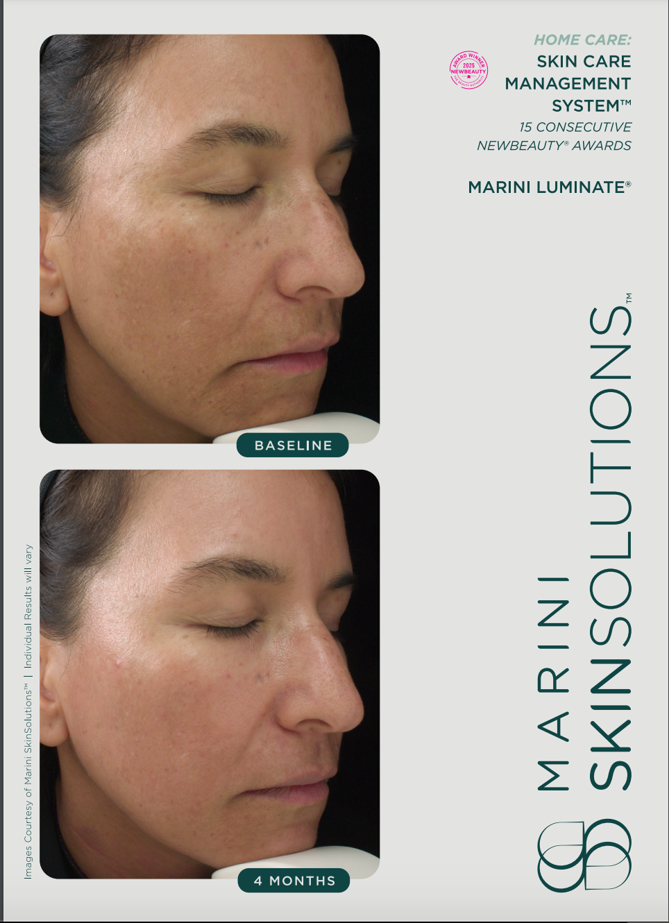 Marini Luminate XC