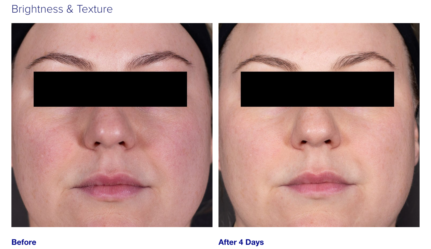 iS Clinical Retinol + Emulsion 0.3