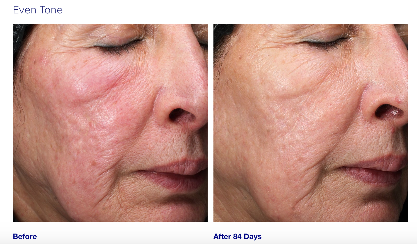 iS Clinical Retinol + Emulsion 0.3