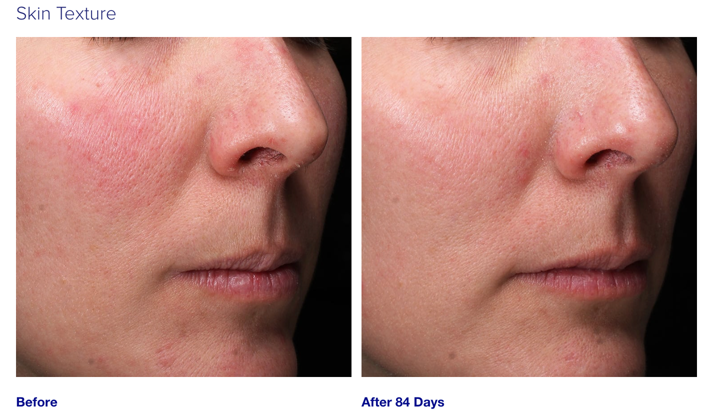 iS Clinical Retinol + Emulsion 0.3