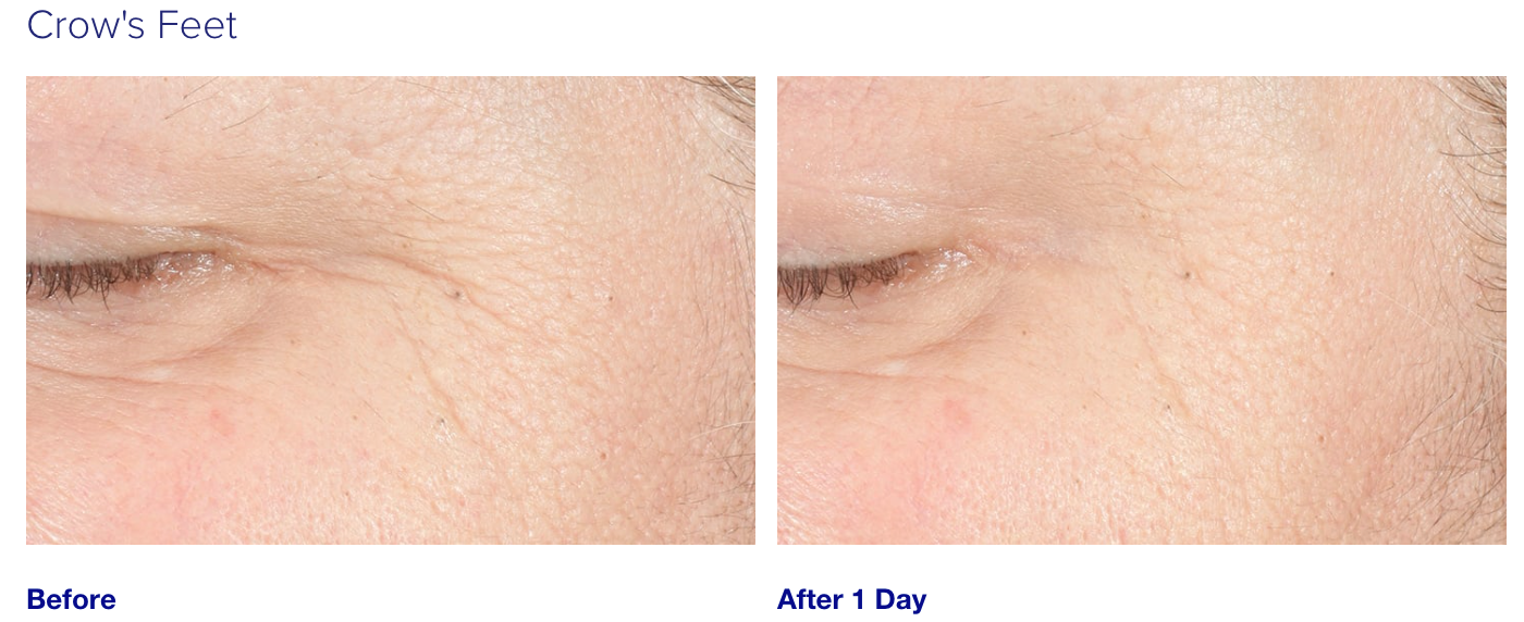 iS Clinical Youth Intensive Cream