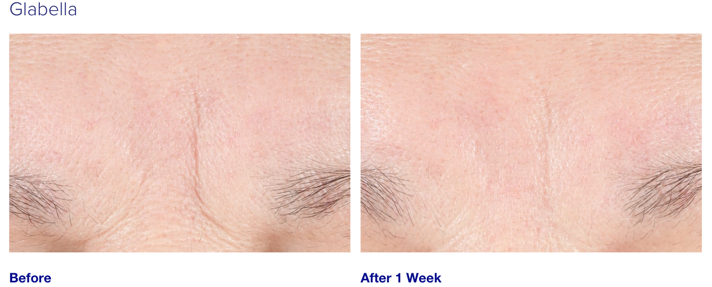 iS Clinical Youth Intensive Cream