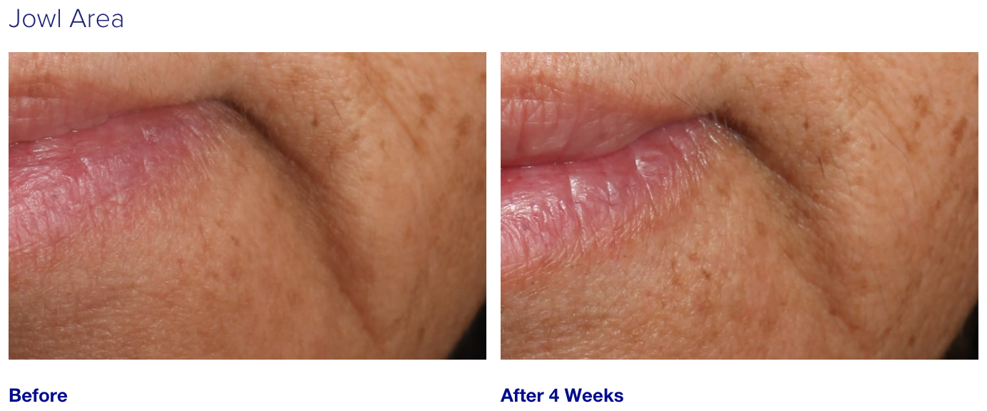iS Clinical Youth Intensive Cream